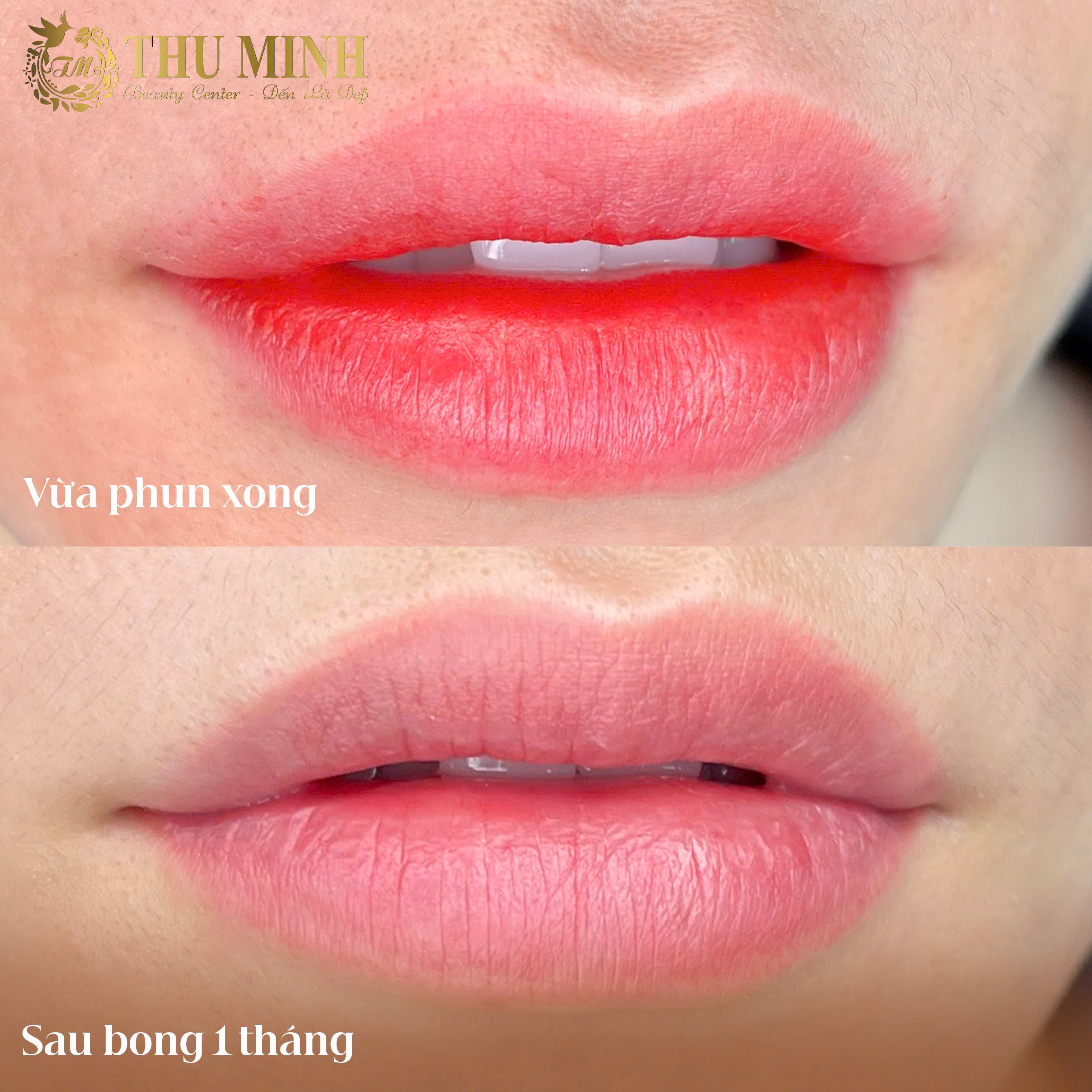 PHUN XĂM THẨM MỸ 2026 CÓ ƯU ĐIỂM VÀ NHƯỢC ĐIỂM GÌ