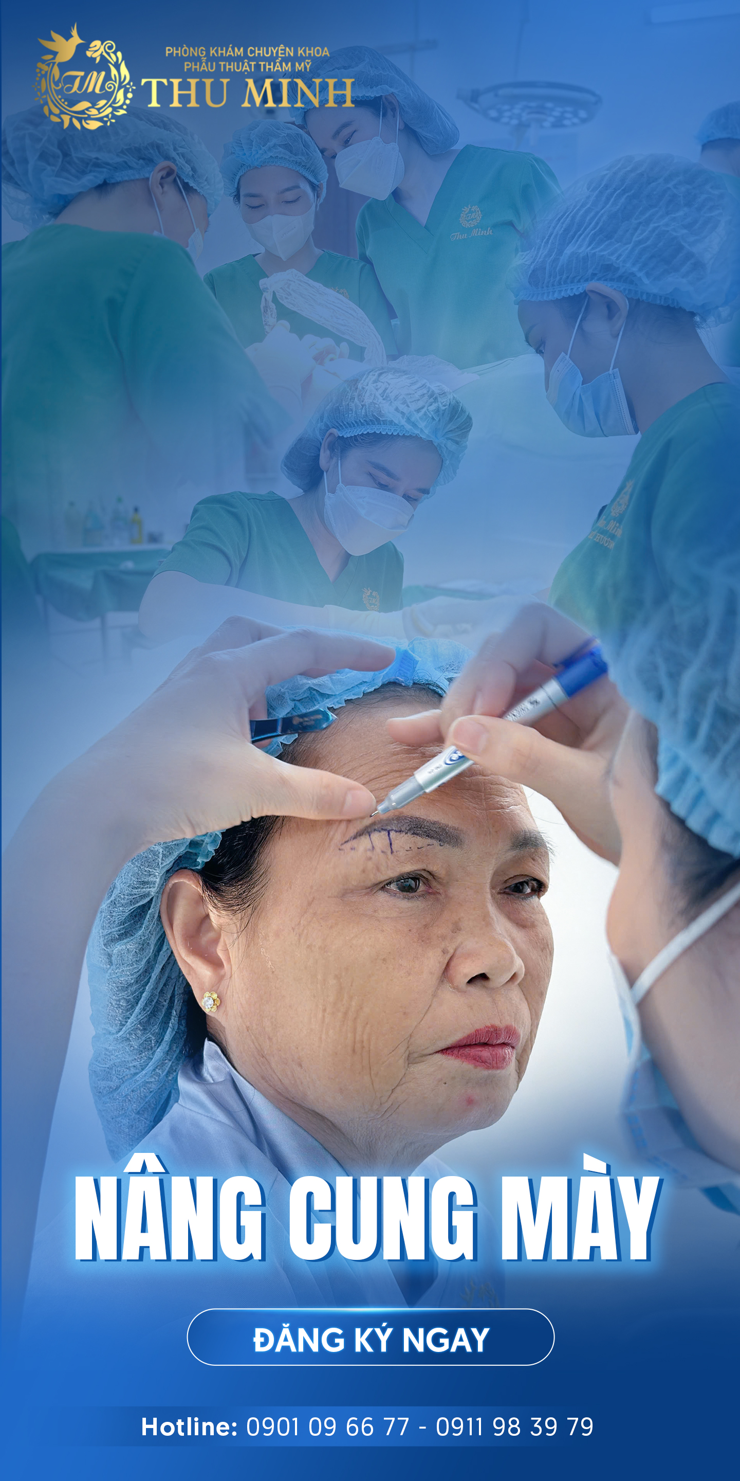 TREO CUNG MÀY LÀ GÌ? TẤT TẦN TẬT KIẾN THỨC TRƯỚC KHI THỰC HIỆN 2026