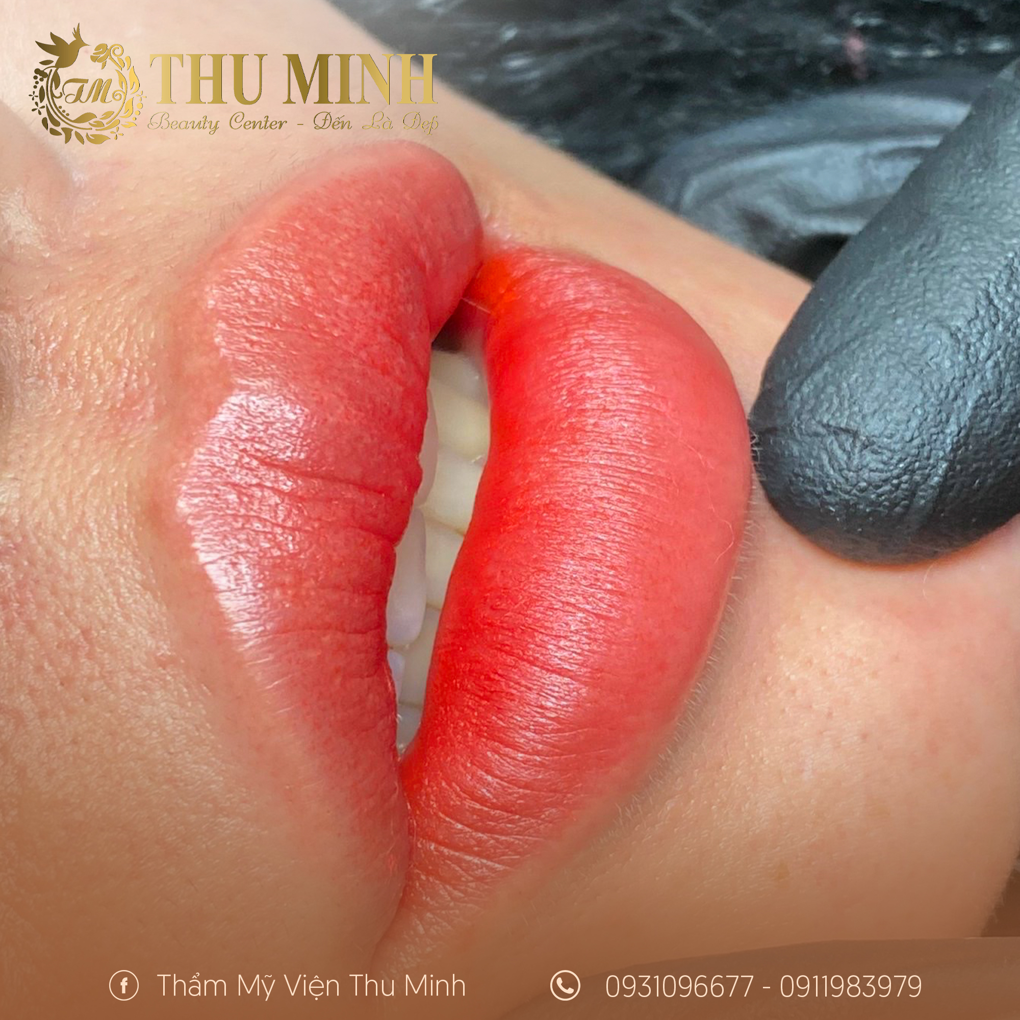 LÝ DO NÊN CHỌN PHUN MÔI COLLAGEN 2026 TẠI THẨM MỸ VIỆN THU MINH CẦN THƠ