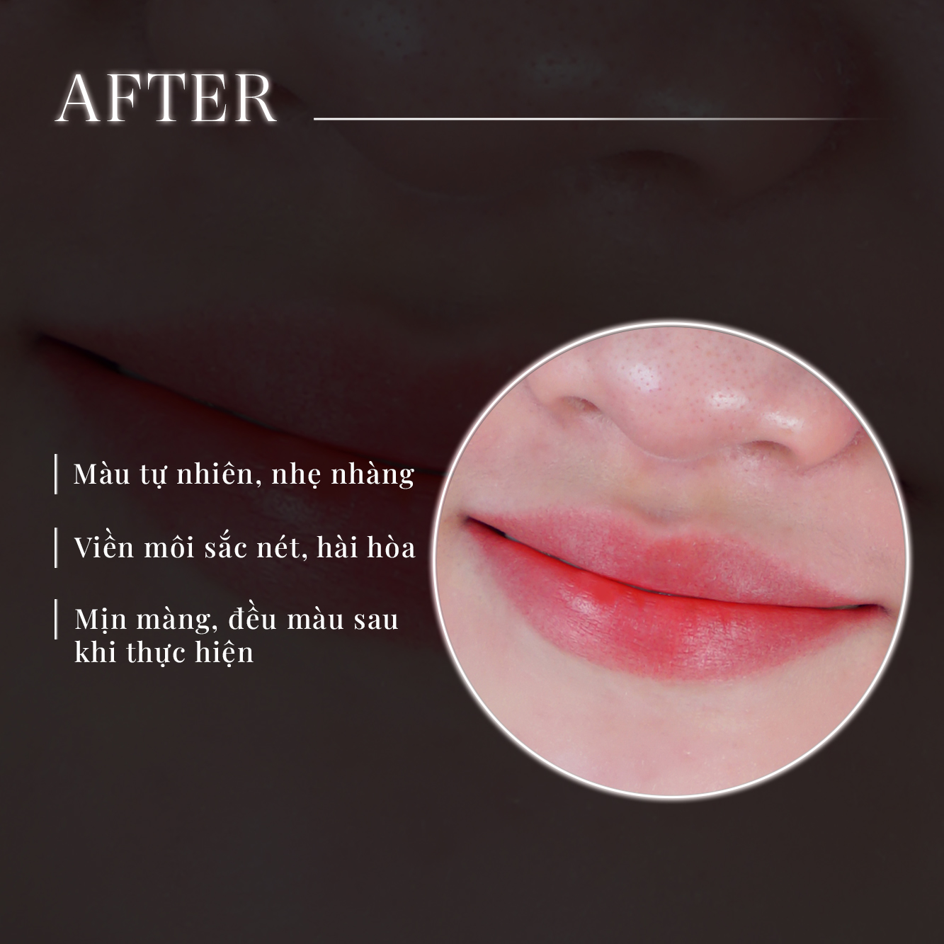 công nghệ phun môi