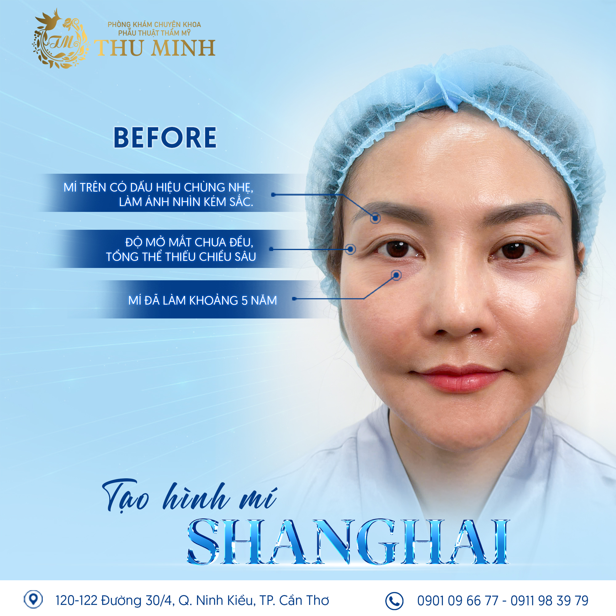 mí shanghai là gì