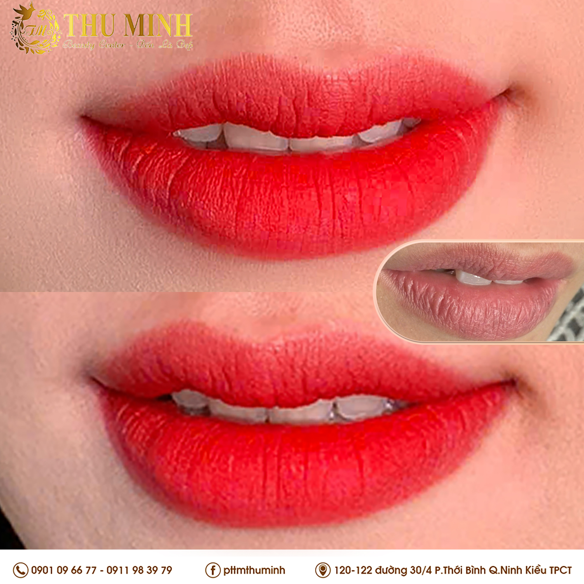 //thuminhbeauty.com/files/images/3(1).jpg
