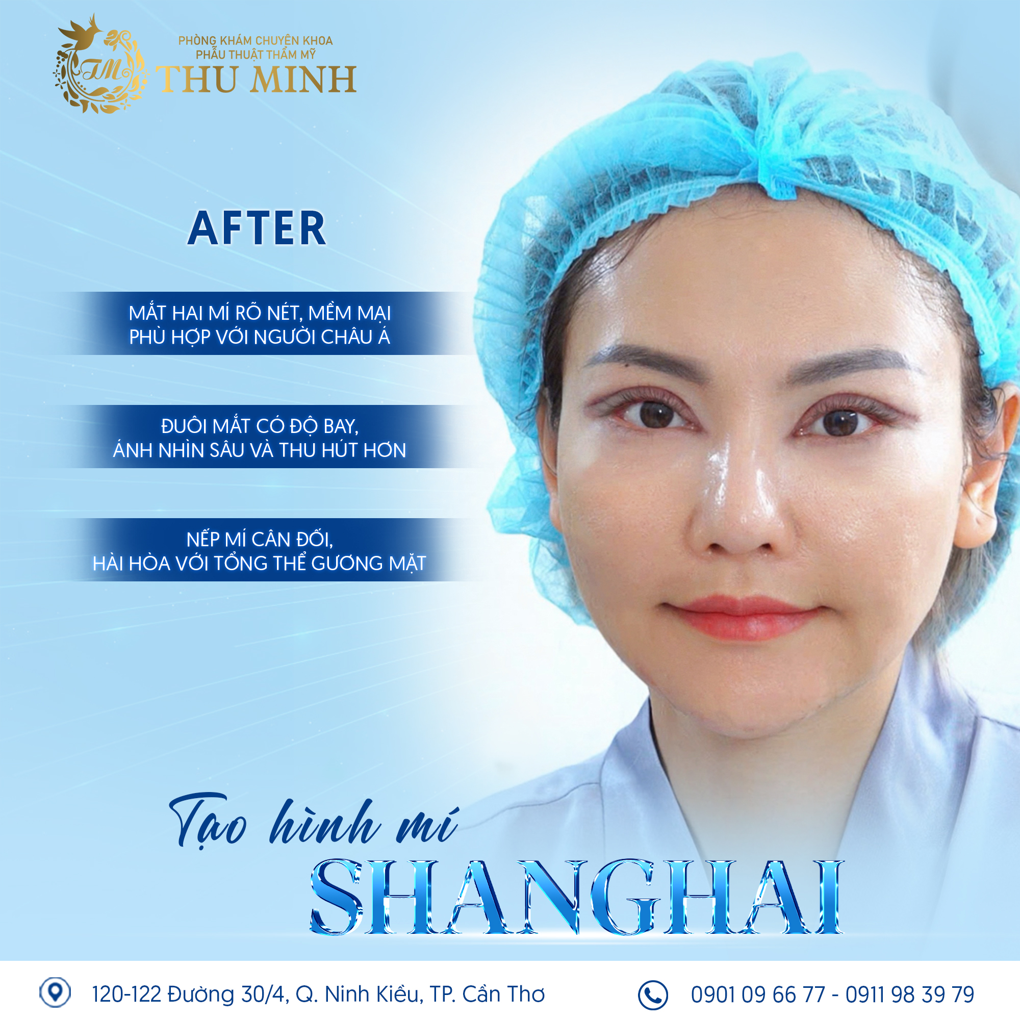 mí shanghai là gì