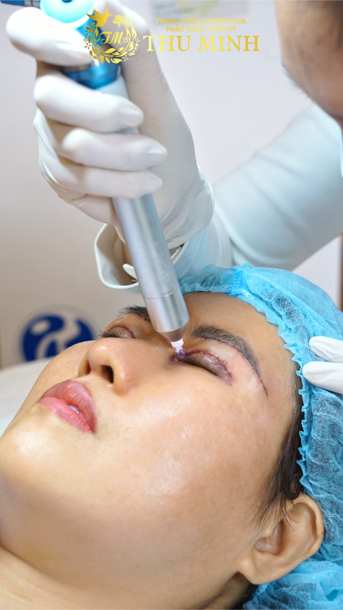 phục hồi sau phẫu thuật