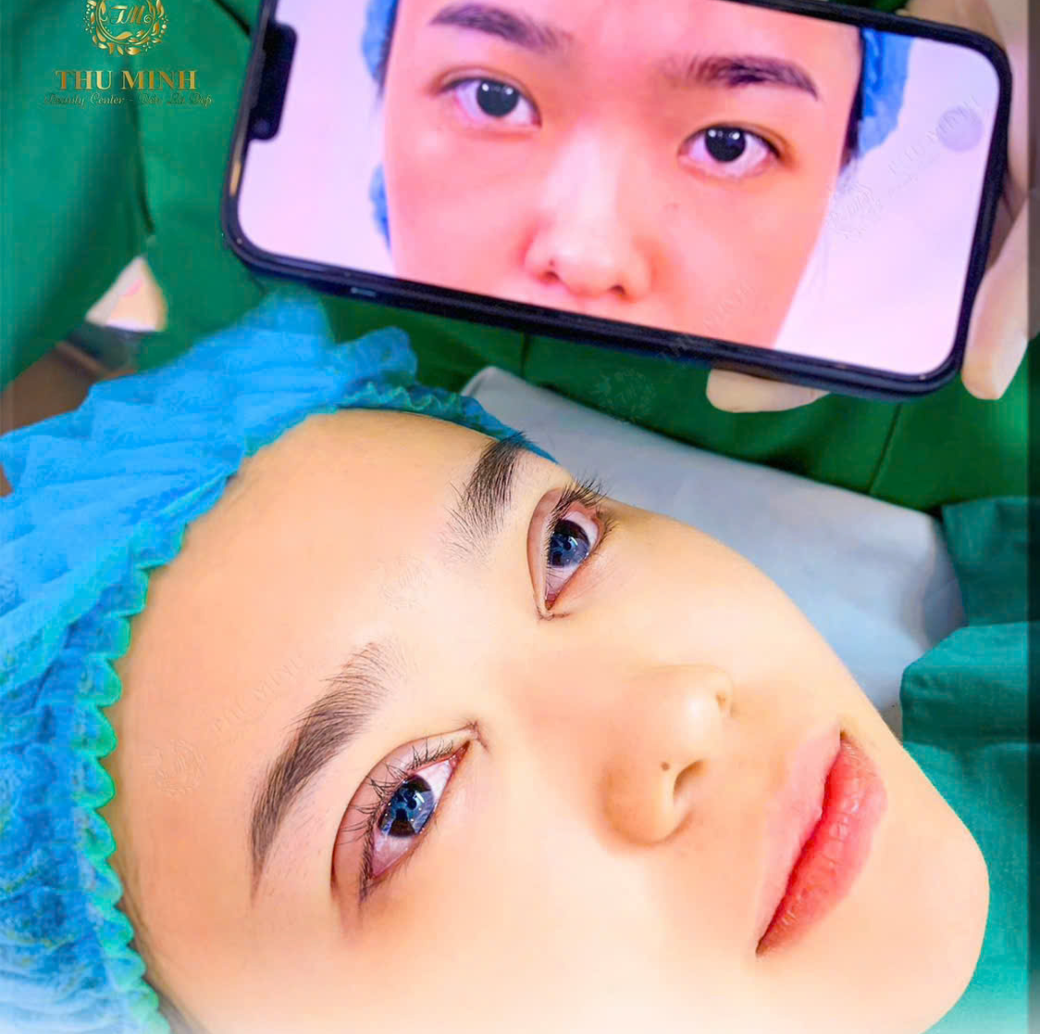 Nhấn Mí