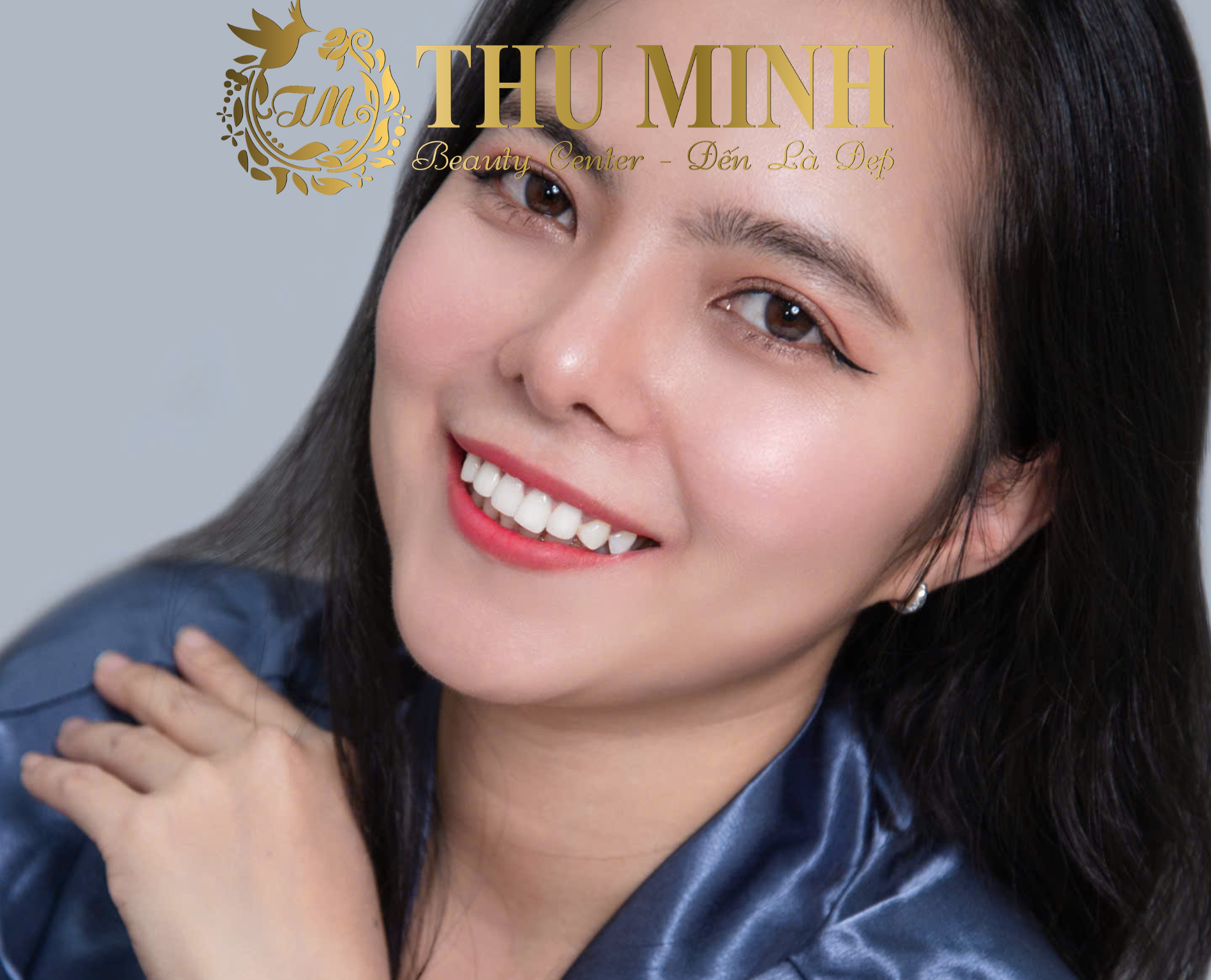 phẫu thuật cằm
