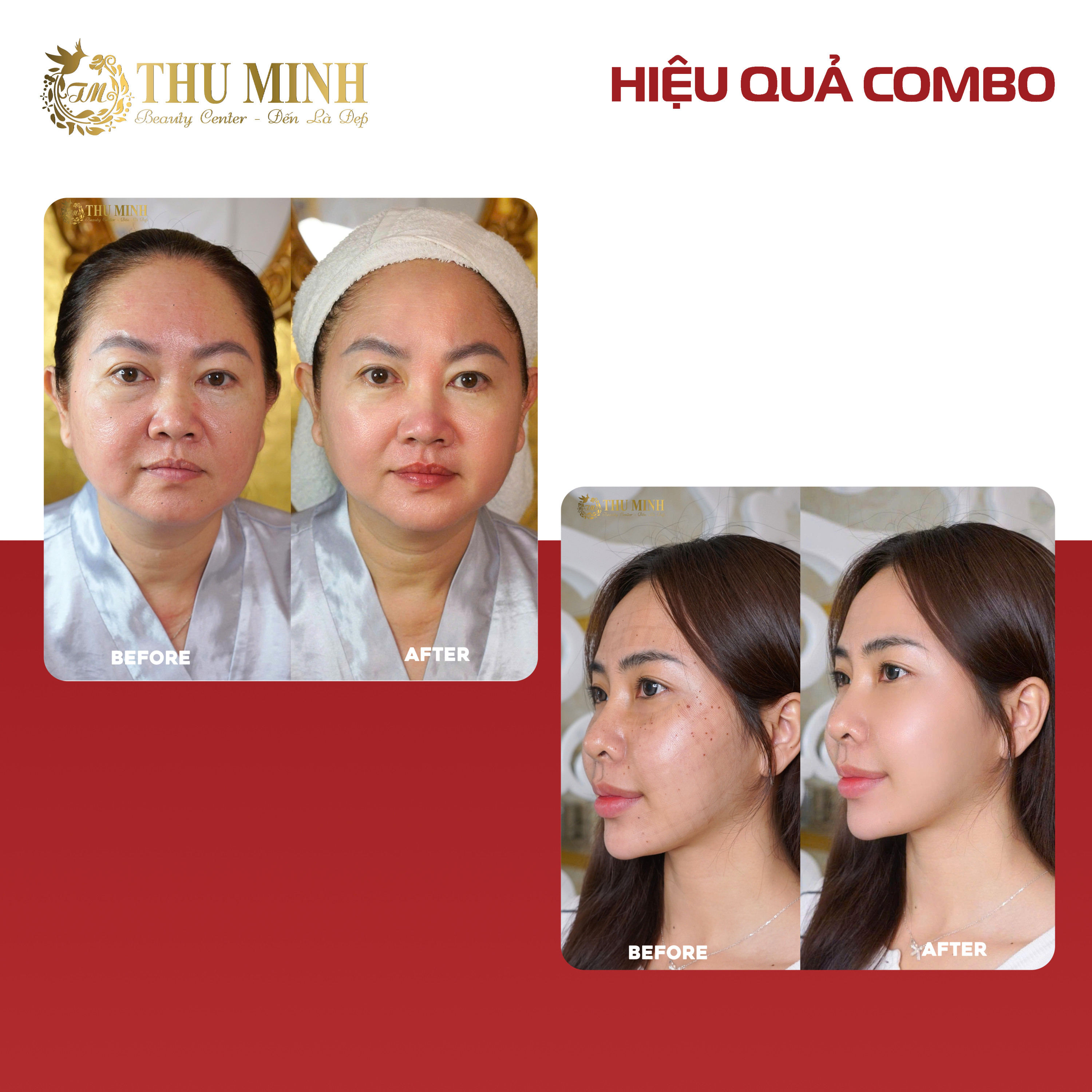 trẻ hoá da mặt