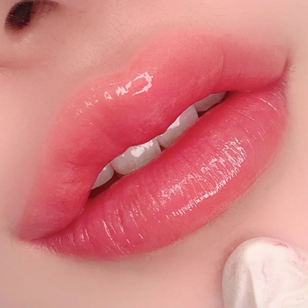 Trẻ