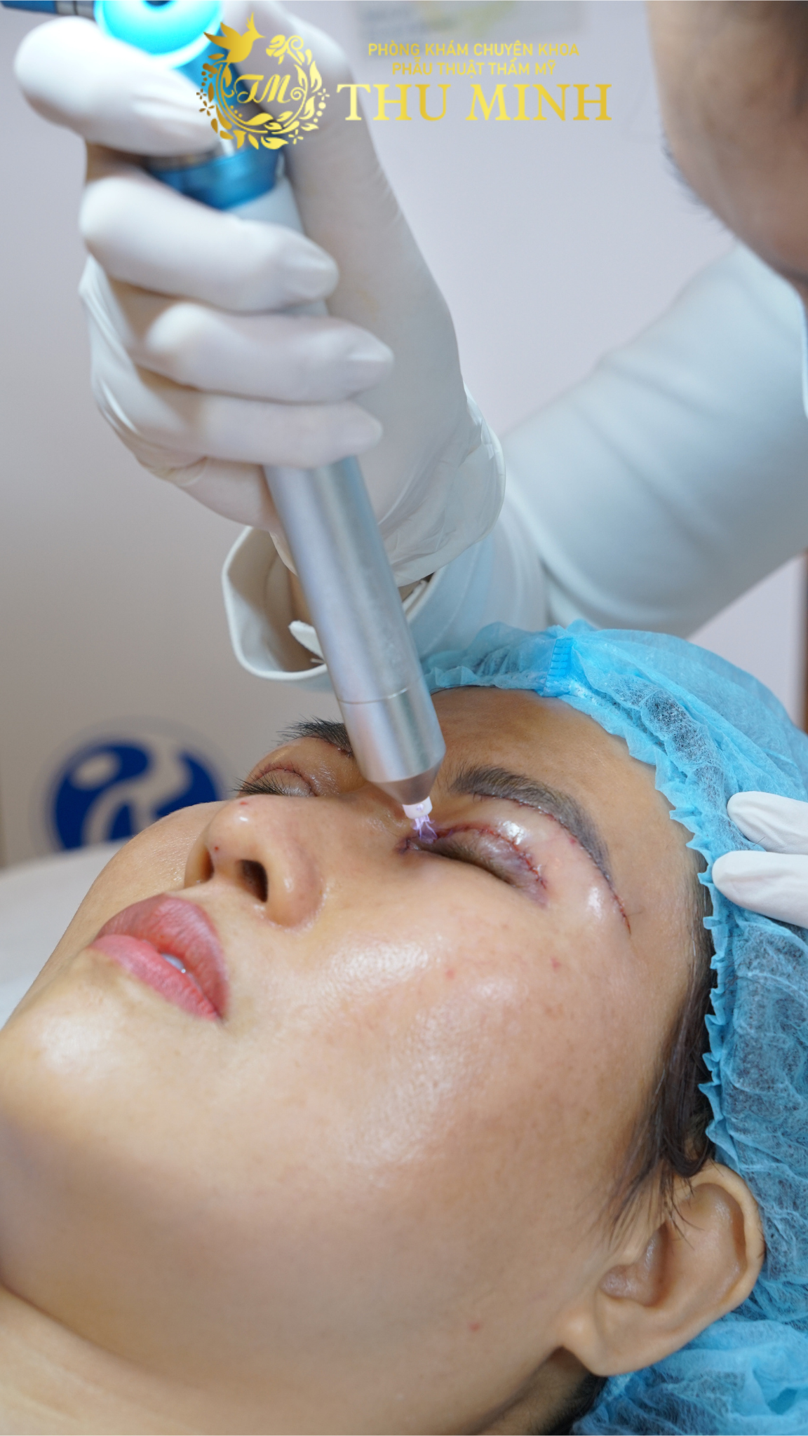 phục hồi sau phẫu thuật