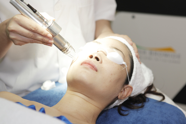 Trị nám da bằng phương pháp toner peeling